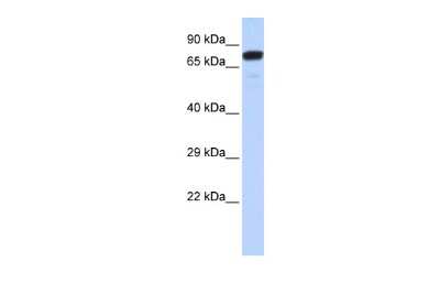 Western Blot ZNF221 Antibody - BSA Free