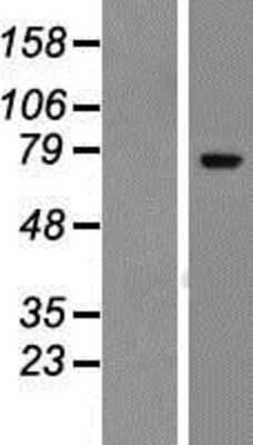 Western Blot: ZNF221 Overexpression Lysate (Adult Normal) [NBP2-07422] Left-Empty vector transfected control cell lysate (HEK293 cell lysate); Right -Over-expression Lysate for ZNF221.
