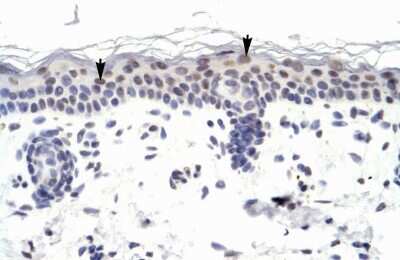 Immunohistochemistry: ZNF223 Antibody [NBP2-86458] - Human Skin