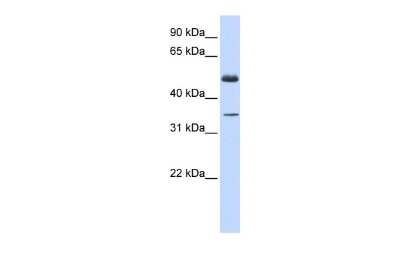 Western Blot: ZNF223 Antibody [NBP2-86457] - WB Suggested Anti-ZNF223 Antibody Titration: 0.2-1 ug/ml. ELISA Titer: 1:62500. Positive Control: Human Muscle