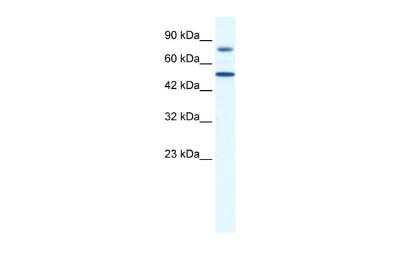 Western Blot: ZNF223 Antibody [NBP2-86458] - WB Suggested Anti-ZNF223 Antibody Titration: 0.2-1 ug/ml. ELISA Titer: 1:12500. Positive Control: Jurkat cell lysate