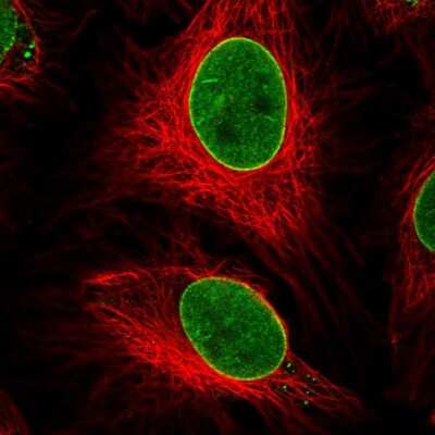 Immunocytochemistry/Immunofluorescence: ZNF224 Antibody [NBP2-30794] - Staining of human cell line HeLa shows localization to nucleoplasm & nuclear membrane. Antibody staining is shown in green.