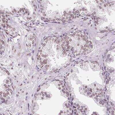 Immunohistochemistry-Paraffin: ZNF224 Antibody [NBP2-30794] -  Staining of human prostate shows weak positivity in nuclear membrane in glandular cells.