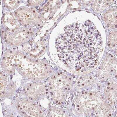 Immunohistochemistry-Paraffin: ZNF224 Antibody [NBP2-30794] - Staining of human kidney shows moderate nuclear positivity in cells in tubules, as well as moderate nuclear membrane positivity in glomeruli cells.