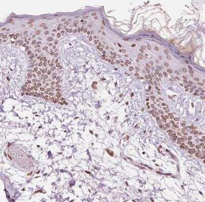 Immunohistochemistry-Paraffin: ZNF224 Antibody [NBP2-30794] -  Staining of human skin shows moderate positivity in nuclear membrane in squamous epithelial cells.