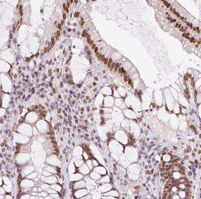 Immunohistochemistry-Paraffin: ZNF224 Antibody [NBP2-30794] - Staining of human rectum shows moderate positivity in nuclear membrane and nucleoplasm in glandular cells.