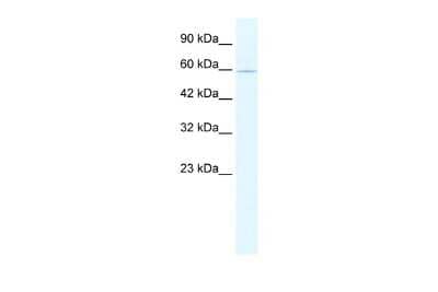 Western Blot ZNF224 Antibody - BSA Free