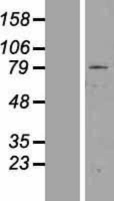 Western Blot: ZNF225 Overexpression Lysate (Adult Normal) [NBP2-07423] Left-Empty vector transfected control cell lysate (HEK293 cell lysate); Right -Over-expression Lysate for ZNF225.