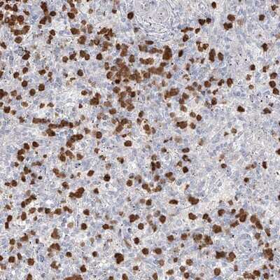 Immunohistochemistry-Paraffin: ZNF227 Antibody [NBP1-85930] - Staining of human spleen shows strong cytoplasmic positivity in subsets of cells in red pulp.