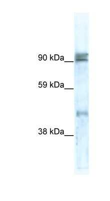 Western Blot: ZNF227 Antibody [NBP1-80193] - Human Small Intestine, concentration 0.2-1 ug/ml.