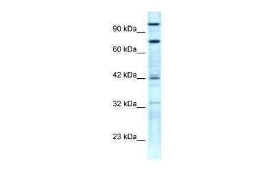 Western Blot: ZNF23 Antibody [NBP2-88657] - WB Suggested Anti-ZNF23 Antibody Titration: 0.2-1 ug/ml. Positive Control: Jurkat cell lysate