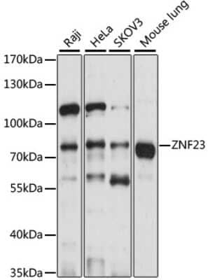Western Blot: ZNF23 Antibody [NBP2-94684] - Analysis of extracts of various cell lines, using ZNF23 at 1:1000 dilution. Secondary antibody: HRP Goat Anti-Rabbit IgG (H+L) at 1:10000 dilution. Lysates/proteins: 25ug per lane. Blocking buffer: 3% nonfat dry milk in TBST. Detection: ECL Basic Kit . Exposure time: 10s.