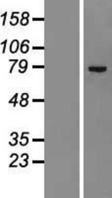 Western Blot: ZNF23 Overexpression Lysate (Adult Normal) [NBL1-18092] Left-Empty vector transfected control cell lysate (HEK293 cell lysate); Right -Over-expression Lysate for ZNF23.