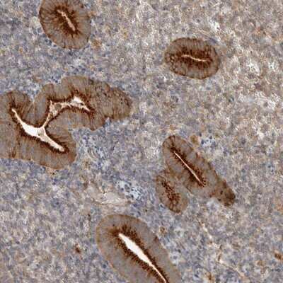 Immunohistochemistry-Paraffin: ZNF232 Antibody [NBP1-86822] - Staining of human corpus, uterine shows strong cytoplasmic positivity in glandular cells.