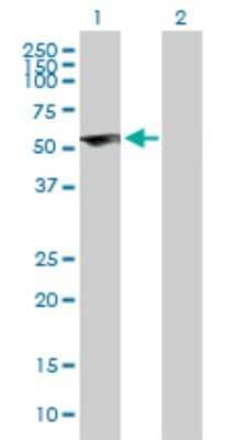 Western Blot: ZNF232 Antibody [H00007775-B01P] - Analysis of ZNF232 expression in transfected 293T cell line by ZNF232 polyclonal antibody.  Lane 1: ZNF232 transfected lysate(48.84 KDa). Lane 2: Non-transfected lysate.