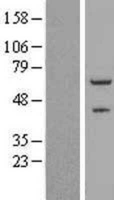 Western Blot: ZNF232 Overexpression Lysate (Adult Normal) [NBL1-18094] Left-Empty vector transfected control cell lysate (HEK293 cell lysate); Right -Over-expression Lysate for ZNF232.