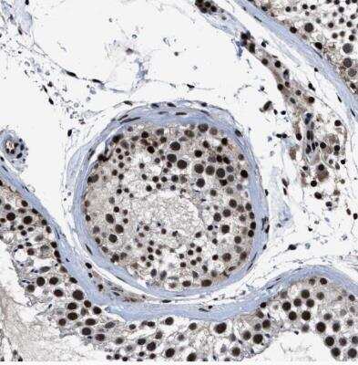 Immunohistochemistry-Paraffin: ZNF233 Antibody [NBP1-81942] - Staining of human testis shows strong nuclear positivity in cells in seminiferous ducts and Leydig cells.