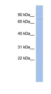 Western Blot: ZNF233 Antibody [NBP1-80192] - Human Thymus lysate, concentration 0.2-1 ug/ml.