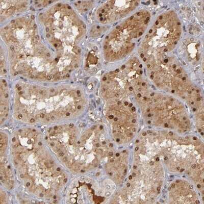 Immunohistochemistry-Paraffin ZNF234 Antibody - BSA Free