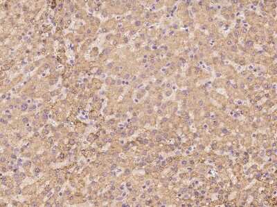 Immunohistochemistry-Paraffin: ZNF234 Antibody [NBP3-06253] - Immunochemical staining of human ZNF234 in human liver with rabbit polyclonal antibody at 1:100 dilution, formalin-fixed paraffin embedded sections.