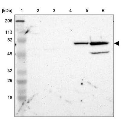 Western Blot ZNF234 Antibody - BSA Free
