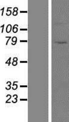 Western Blot: ZNF234 Overexpression Lysate (Adult Normal) [NBP2-07601] Left-Empty vector transfected control cell lysate (HEK293 cell lysate); Right -Over-expression Lysate for ZNF234.
