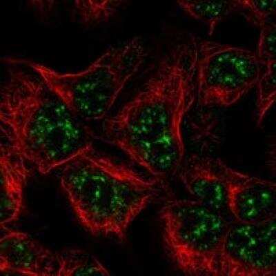 Immunocytochemistry/Immunofluorescence: ZNF238 Antibody [NBP3-17097] - Staining of human cell line HAP1 shows localization to nuclear speckles.