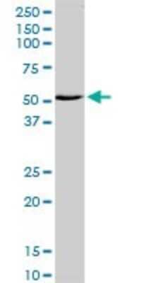 Western Blot: ZNF238 Antibody [H00010472-D01P] - Analysis of ZNF238 expression in HeLa.