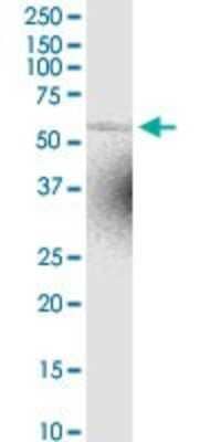 Western Blot: ZNF238 Antibody [H00010472-D01P] - Analysis of ZNF238 expression in IMR-32.
