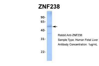 Western Blot: ZNF238 Antibody [NBP2-82381] - Host: Rabbit. Target Name: ZNF238. Sample Type: Human Fetal Liver. Antibody Dilution: 1.0ug/ml