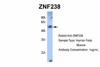 Western Blot: ZNF238 Antibody [NBP2-82381] - Host: Rabbit. Target Name: ZNF238. Sample Type: Human Fetal Muscle. Antibody Dilution: 1.0ug/ml