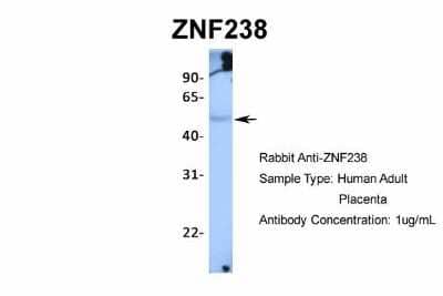 Western Blot: ZNF238 Antibody [NBP2-82381] - Host: Rabbit. Target Name: ZNF238. Sample Type: Human Adult Placenta. Antibody Dilution: 1.0ug/ml
