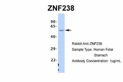 Western Blot: ZNF238 Antibody [NBP2-82381] - Host: Rabbit. Target Name: ZNF238. Sample Type: Human Fetal Stomach. Antibody Dilution: 1.0ug/ml