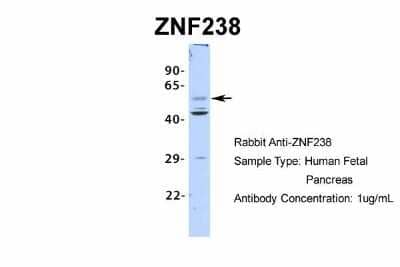 Western Blot: ZNF238 Antibody [NBP2-82381] - Host: Rabbit. Target Name: ZNF238. Sample Type: Human Fetal Pancreas. Antibody Dilution: 1.0ug/ml