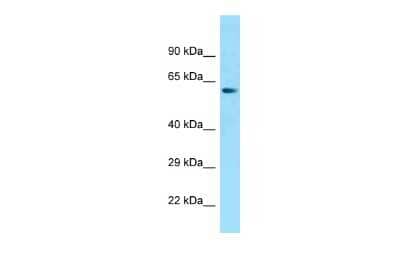 Western Blot: ZNF238 Antibody [NBP2-82382] - WB Suggested Anti-ZNF238 Antibody. Titration: 1.0 ug/ml. Positive Control: THP-1 Whole Cell