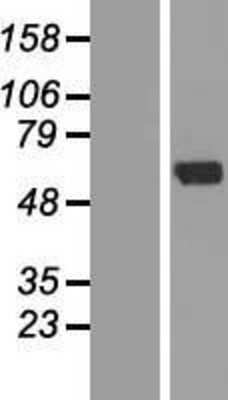 Western Blot: ZNF238 Overexpression Lysate (Adult Normal) [NBL1-18096] Left-Empty vector transfected control cell lysate (HEK293 cell lysate); Right -Over-expression Lysate for ZNF238.