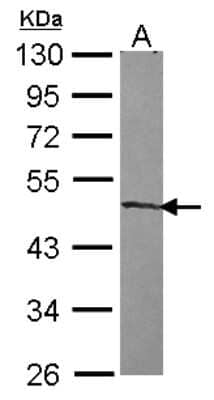 Western Blot: ZNF239 Antibody [NBP2-20980] - Sample (30 ug of whole cell lysate) A: IMR32 10% SDS PAGE gel, diluted at 1:1000.