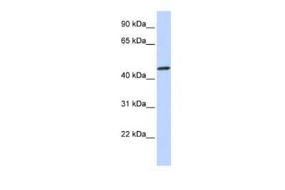 Western Blot: ZNF239 Antibody [NBP3-10456] - Western blot analysis using NBP3-10456 on Human Brain  as a positive control. Antibody Titration: 0.2-1 ug/ml