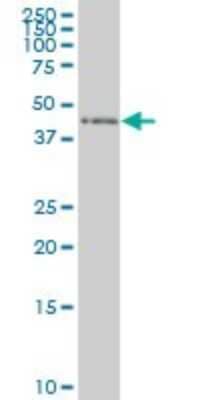 Western Blot: ZNF24 Antibody (2G5) [H00007572-M02] - ZNF24 monoclonal antibody (M02), clone 2G5 Analysis of ZNF24 expression in Hela S3 NE.