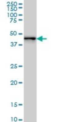 Western Blot: ZNF24 Antibody (4A1) [H00007572-M01] - ZNF24 monoclonal antibody (M01), clone 4A1 Analysis of ZNF24 expression in Hela S3 NE.