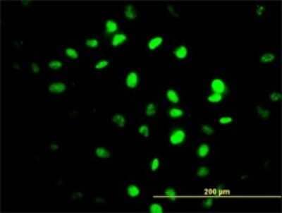 Immunocytochemistry/Immunofluorescence: ZNF24 Antibody (4C2) [H00007572-M03] - Analysis of monoclonal antibody to ZNF24 on HeLa cell. Antibody concentration 10 ug/ml