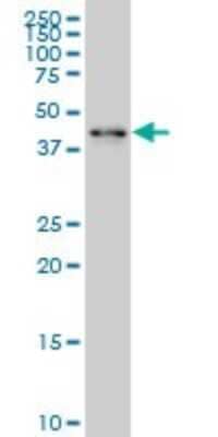 Western Blot: ZNF24 Antibody (4C2) [H00007572-M03] - Analysis of ZNF24 expression in Hela S3 NE (Cat # L013V3).