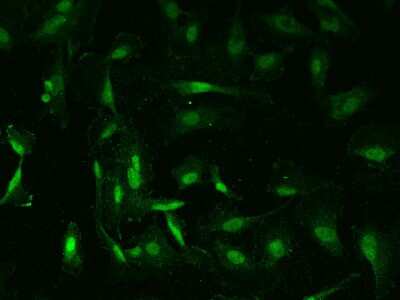 Immunocytochemistry/Immunofluorescence: ZNF24 Antibody [NBP2-97861] - Immunofluorescence staining of ZNF24 in U251MG cells. Cells were fixed with 4% PFA, permeabilzed with 0.1% Triton X-100 in PBS, blocked with 10% serum, and incubated with rabbit anti-Human ZNF24 polyclonal antibody (dilution ratio 1:200) at 4C overnight. Then cells were stained with the Alexa Fluor(R)488-conjugated Goat Anti-rabbit IgG secondary antibody (green). Positive staining was localized to Nucleus.