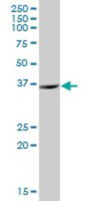 Western Blot: ZNF24 Antibody [H00007572-B01P] - Analysis of ZNF24 expression in human liver.