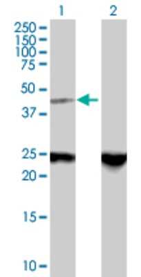 Western Blot: ZNF24 Antibody [H00007572-B01P] - Analysis of ZNF24 expression in transfected 293T cell line by ZNF24 polyclonal antibody.  Lane 1: ZNF24 transfected lysate(40.48 KDa). Lane 2: Non-transfected lysate.