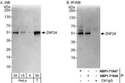 Western Blot: ZNF24 Antibody [NBP1-71847] - Whole cell lysate from HeLa (5, 15 and 50 mcg for WB; 1 mg for IP, 20% of IP loaded) and 293T (T; 50 mcg) cells.  Affinity purified rabbit anti-ZNF24 antibody used for WB at 0.04 mcg/ml (A) and 0.4 mcg/ml (B) and used for IP at 6 mcg/mg lysate.  ZNF24 was also immunoprecipitated by rabbit anti-ZNF24 antibody NBP1-71848 which recognizes a downstream epitope.