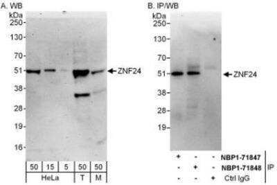 Western Blot: ZNF24 Antibody [NBP1-71848] - Whole cell lysate from HeLa (5, 15 and 50 mcg for WB; 1 mg for IP, 20% of IP loaded), 293T (T; 50 mcg) and mouse NIH3T3 (M; 50 mcg) cells.  Affinity purified rabbit anti-ZNF24 antibody used for WB at 0.04 mcg/ml (A) and 0.4 mcg/ml (B) and used for IP at 6 mcg/mg lysate.  ZNF24 was also immunoprecipitated by rabbit anti-ZNF24 antibody NBP1-71847 which recognizes an upstream epitope.