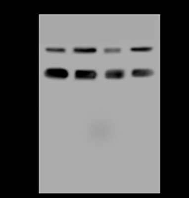 Western Blot: ZNF24 Antibody [NBP2-97861] - Anti-ZNF24 rabbit polyclonal antibody at 1:500 dilution. Lane A: Jurkat Whole Cell Lysate Lane B: HeLa Whole Cell Lysate Lane C: 293 Whole Cell Lysate Lane D: U-251 MG Whole Cell Lysate Lysates/proteins at 30 ug per lane. Secondary Goat Anti-Rabbit IgG (H+L)/HRP at 1/10000 dilution. Developed using the ECL technique. Performed under reducing conditions. Predicted band size: 42 kDa. Observed band size: 45 kDa (We are unsure as to the identity of these extra bands).