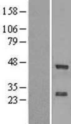 Western Blot: ZNF24 Overexpression Lysate (Adult Normal) [NBL1-18098] Left-Empty vector transfected control cell lysate (HEK293 cell lysate); Right -Over-expression Lysate for ZNF24.