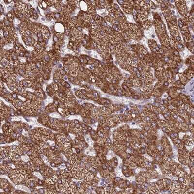 Immunohistochemistry ZNF248 Antibody - BSA Free